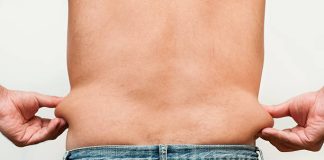 Does Insurance Cover Tummy Tuck